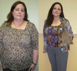 Julia Weight Loss Clinic Davie, Fl