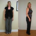 Carol G. Weight Loss Success In Fort Lauderdale