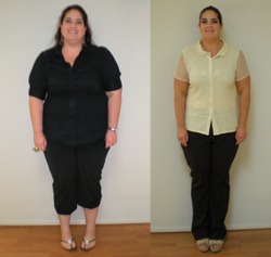 Weight Loss Success In Miramar, Florida