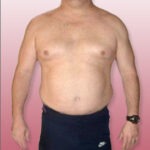 Is Stress Eating Hurting Your Weight Loss Efforts?