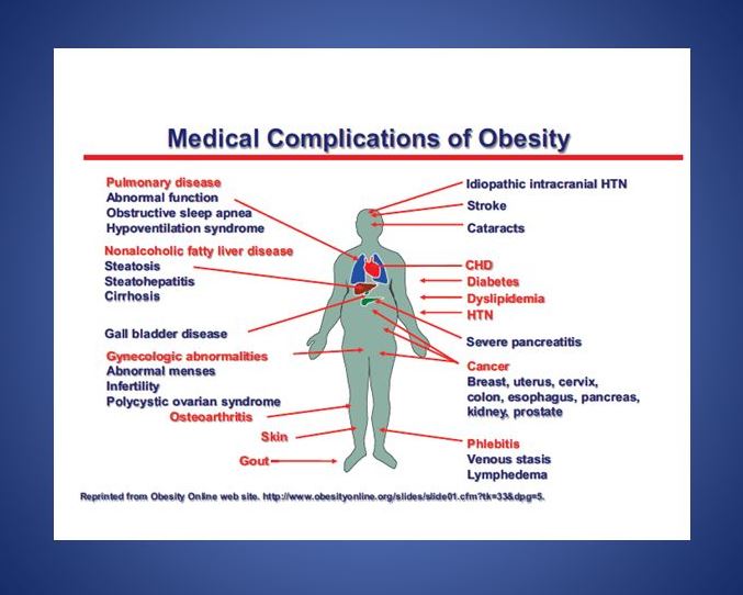 Why You Should Lose Belly Fat: Medical Complications of Obesity