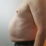 CardioMender, MD Has One of the Few Physicians Board Certified In Obesity Medicine on Staff