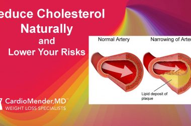 CardioMender, MD Reduce Cholesterol Naturally