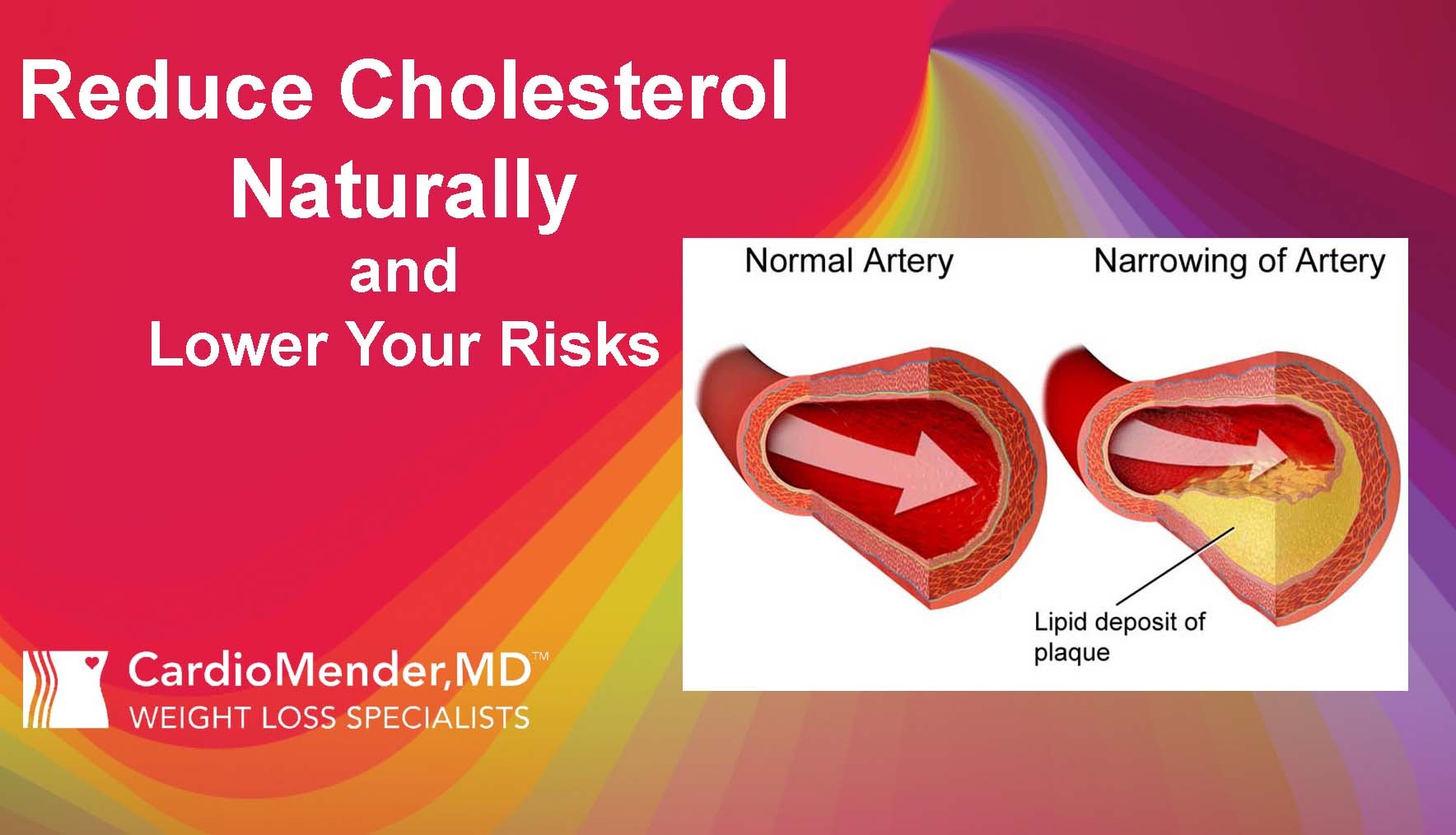 CardioMender, MD reduce cholesterol naturally
