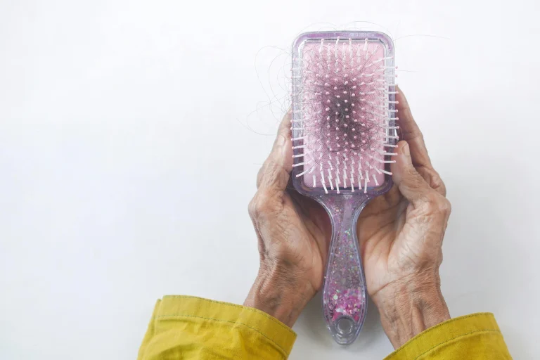 Does Tirzepatide Cause Hair Loss?