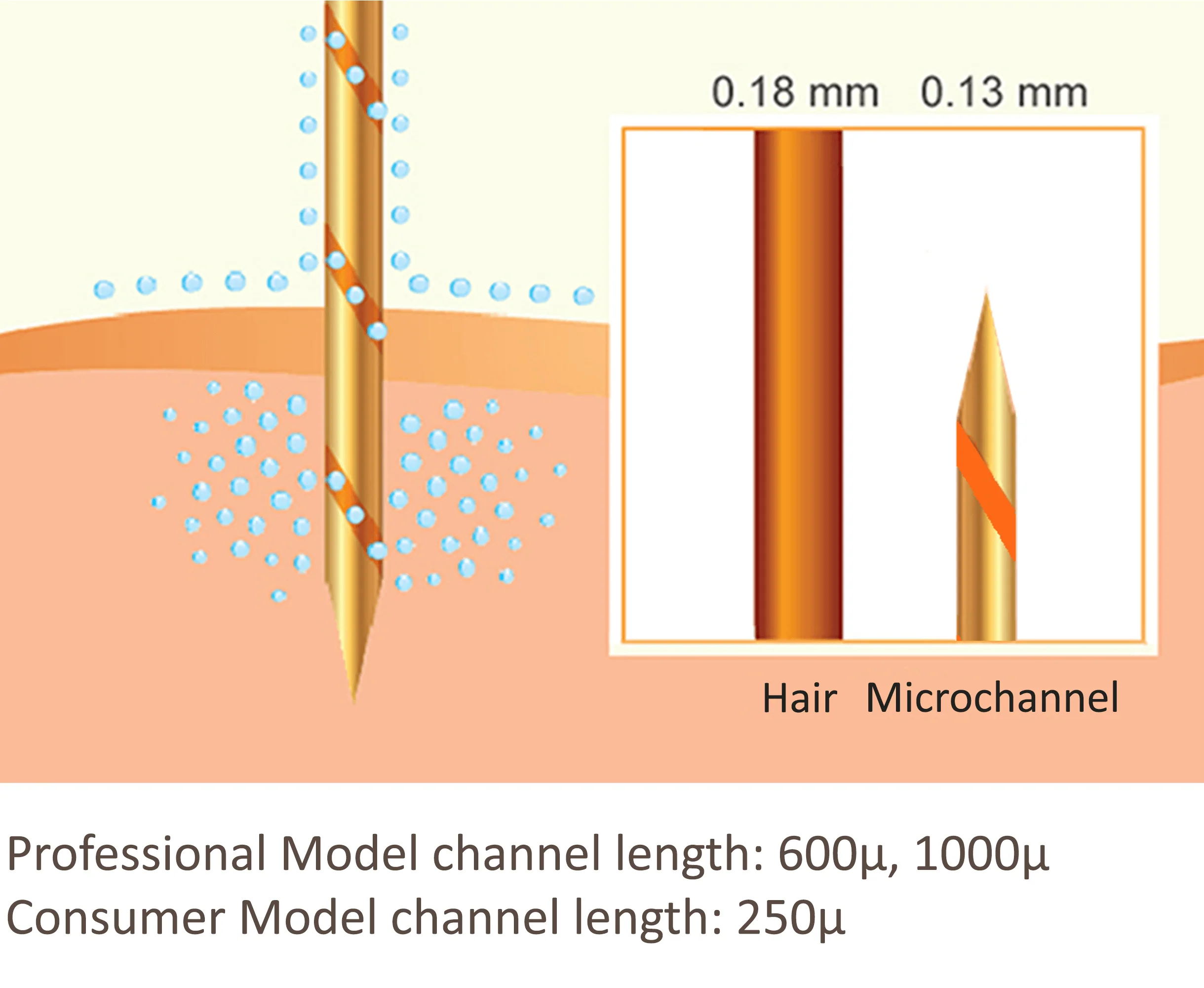 AQUAGOLD Microchannel Technology® — 500-micron gold-plated hollow needles