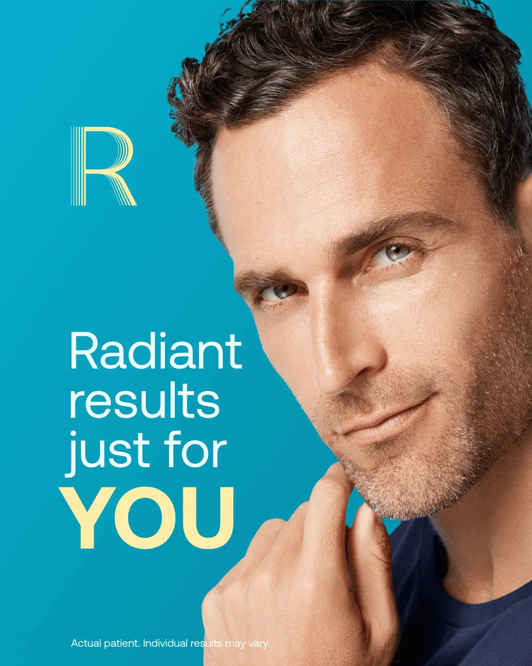 Radiesse treatment for men — radiant results at CardioMender, MD